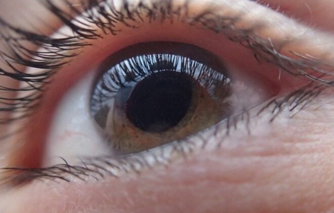 Eye