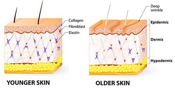 Comparing young and old skin Comparing young and old skin
